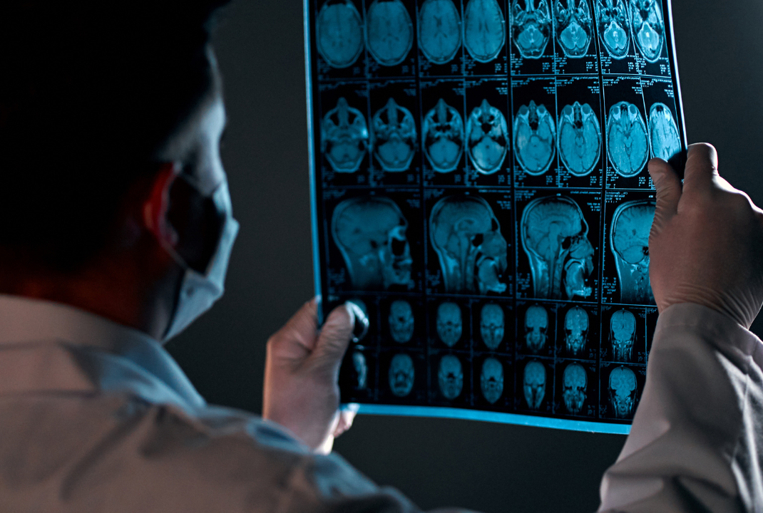 fMRI vs MRI Compared | NYC Therapy Center