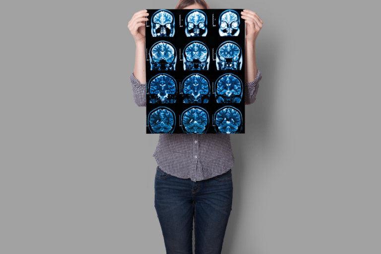 Woman holding brainscan to cover face