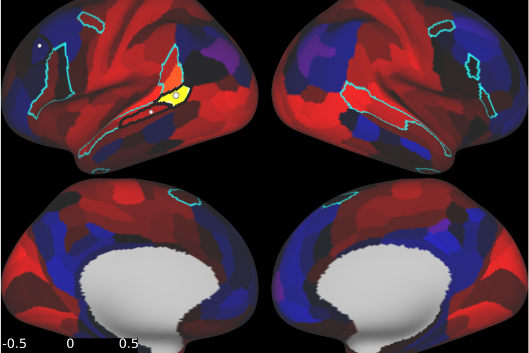 cognitive decline before treatment