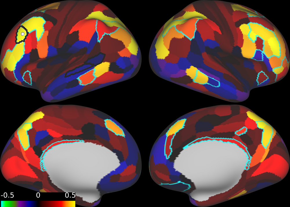 imaging of cognitive impairment in cognitive decline