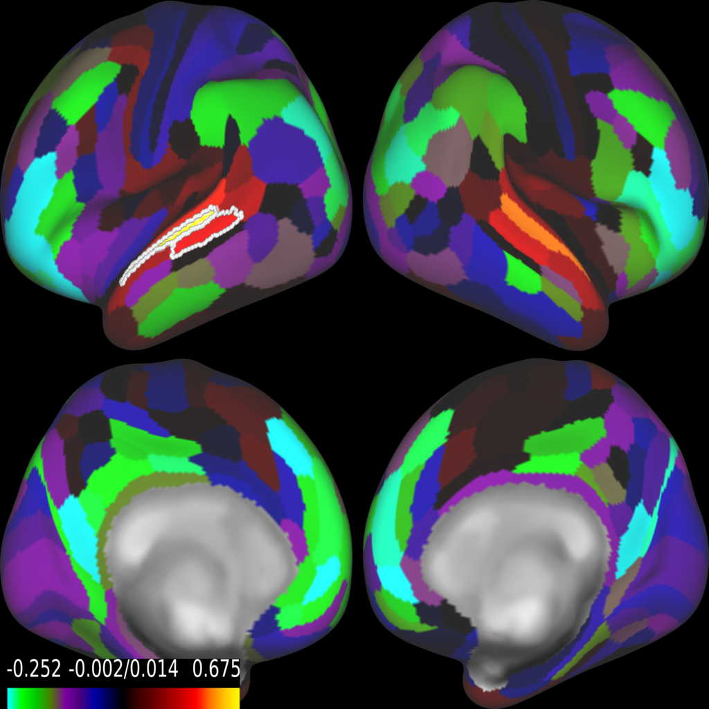 Healthy Brain Scan