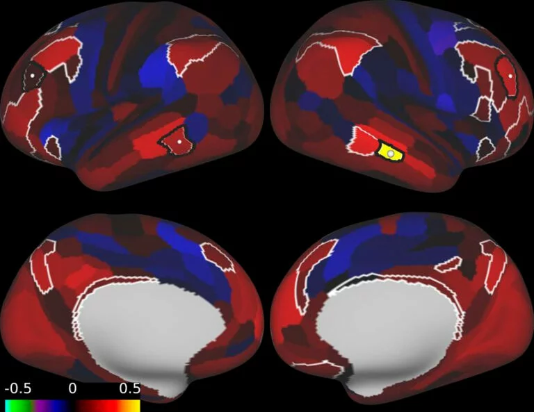 A map of the brain from every angle