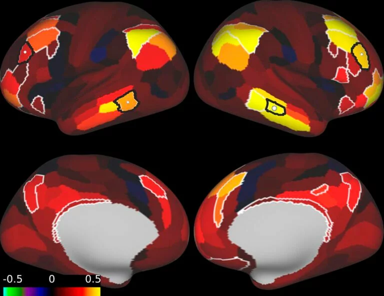 High Contrast Brain Map