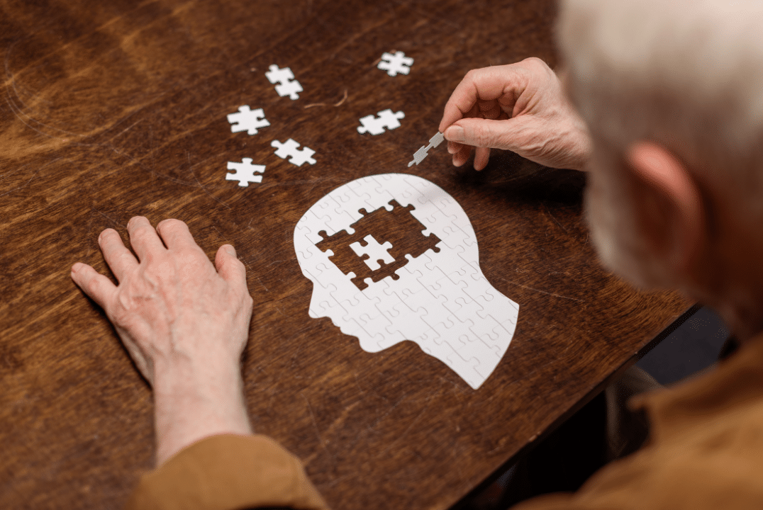 Man With Alzheimers Brain Jigsaw Puzzle
