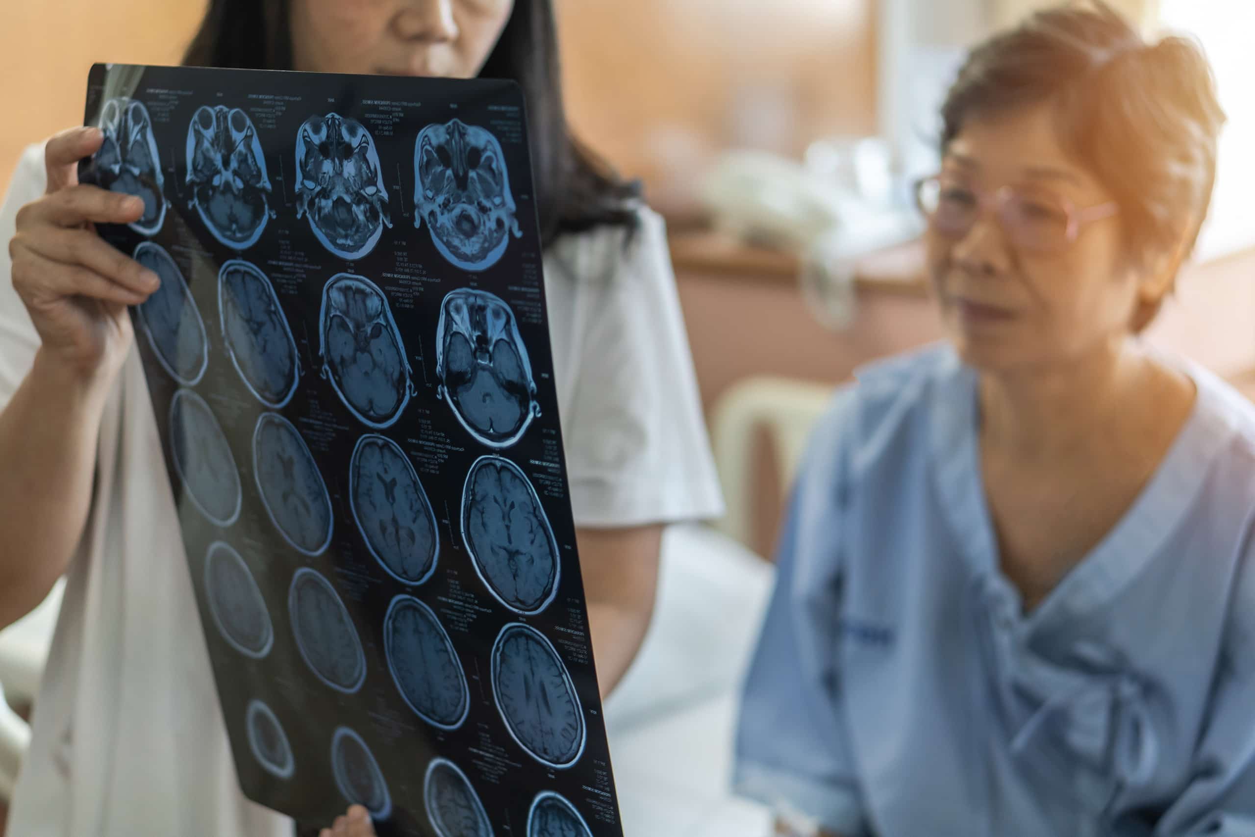 Woman looking at brain scans