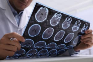 Doctor looking at brain MRI