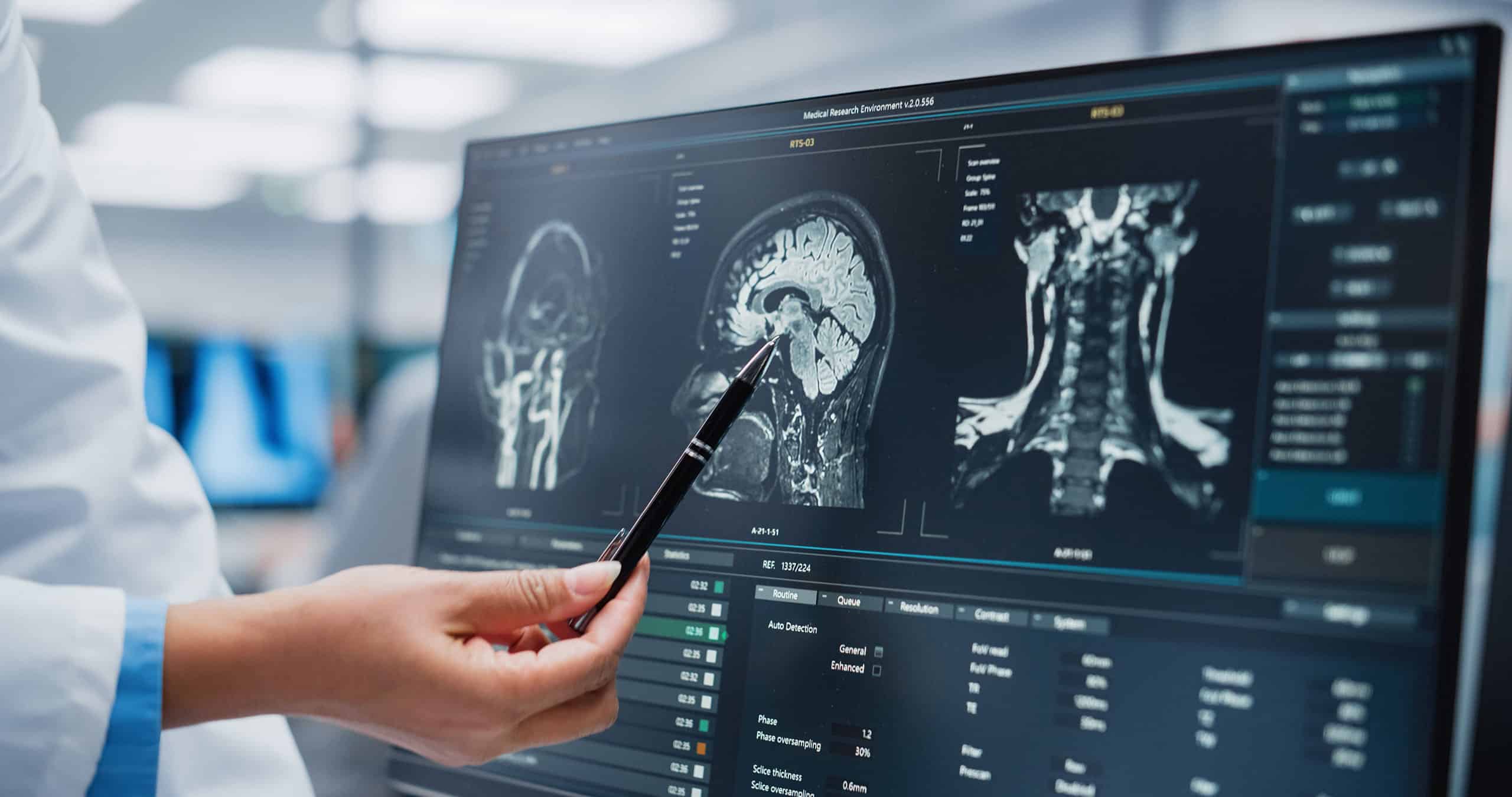 Medical professionals examining brain MRI scans on a computer monitor in a clinical setting.